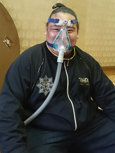 睡眠時無呼吸症候群対策マスクCPAPを着用する荒篤山関